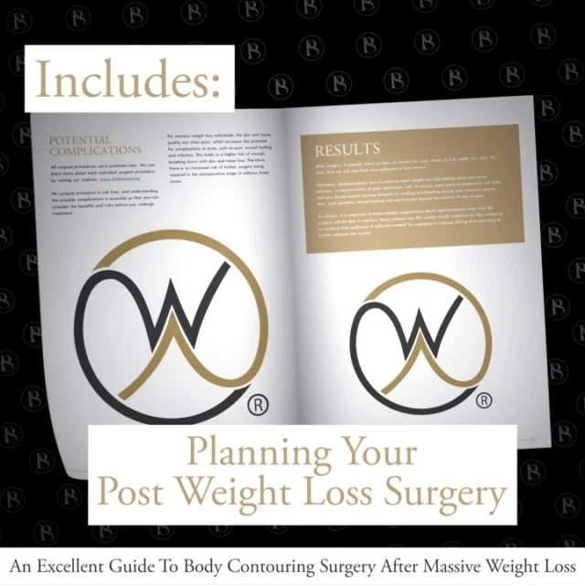 Download our latest BODY CONTOURING eBook for those who are seeking to undergo POST-WEIGHT-LOSS SURGERY. 

https://www.drdonaplasticsurgery.com.au/open-book-tummy-tuck-ebook/

Experience & Excellence in Plastic Surgery is what you deserve.

#BreastImplants #DrEddyDona #PlasticSurgery #BreastAugmentation

All surgery carries risks. You can learn more by visiting our website - link can be found in our
bio.
Or go to http://www.drdonaplasticsurgery.com.au/surgery-risks/

DISCLAIMER: All surgeries on this page are performed by Dr Eddy Dona and are published with the written consent by the patients.
After images are generally taken between 3-6 months post-surgery.
All surgery requires recovery time.
The outcomes shown are only relevant for this patient and do not necessarily reflect the results other patients may experience, even if they have a similar body type or shape.
Results may vary due to many factors including an individual’s genetics and lifestyle.
The content on this page is general in nature and is not a substitute for a formal consultation.
Before proceeding, please seek medical advice from an appropriately qualified medical practitioner.
Dr Eddy Dona is a Specialist Plastic Surgeon
(Registration: MED0001177175)